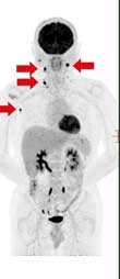 pet/ct