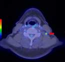 pet/ct