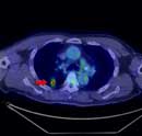 pet/ct