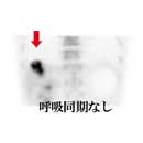 pet/ct