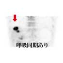 pet/ct